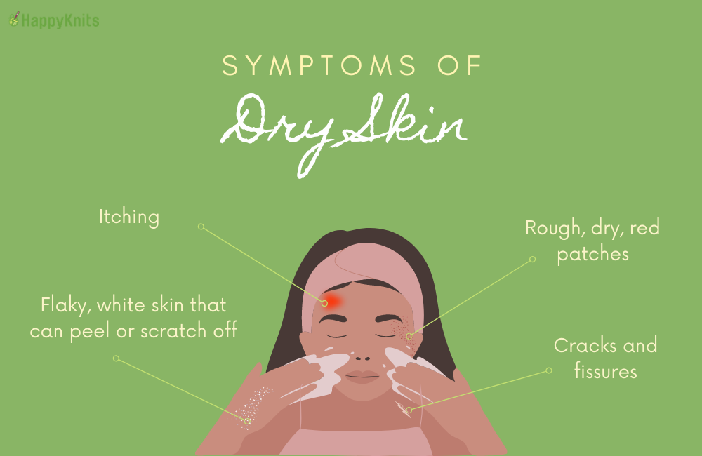 dry skin symptoms