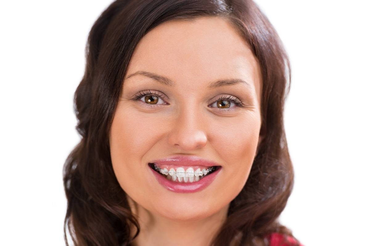 woman with braces