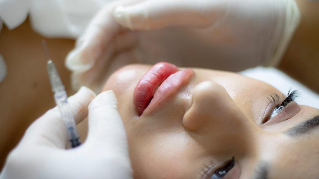lip filling procedure