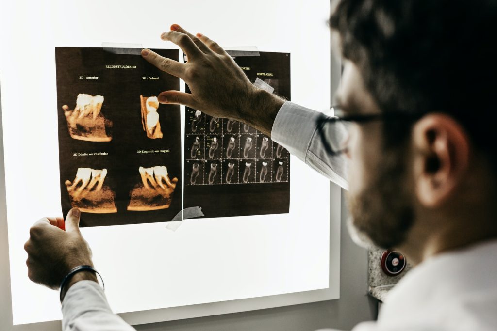dentist holding teeth x-ray